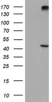 AGPAT5 Antibody