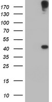 AGPAT5 Antibody