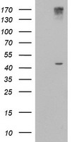 AGPAT5 Antibody