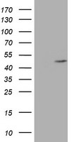 AGPAT5 Antibody
