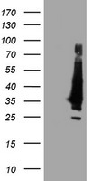 GIRK1 Antibody