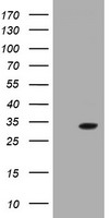 GSTO2 Antibody