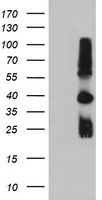 TIMP2 Antibody