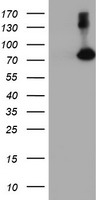 FBXO21 Antibody