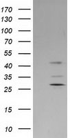 SERPINB2 Antibody