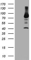 PFKP Antibody