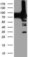 PFKP Antibody
