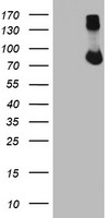 FBXO21 Antibody