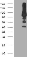 PFKP Antibody