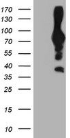 PFKP Antibody