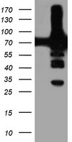 PFKP Antibody