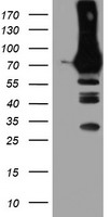 PFKP Antibody
