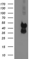 PDSS2 Antibody