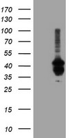 PDSS2 Antibody