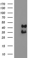 PDSS2 Antibody