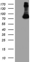 FBXO21 Antibody