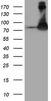 FBXO21 Antibody