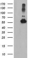TUBAL3 Antibody