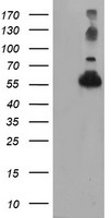 TUBAL3 Antibody