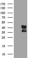 PDSS2 Antibody