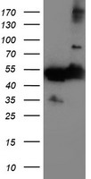 TUBAL3 Antibody