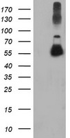 TUBAL3 Antibody