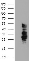 SERPINB2 Antibody