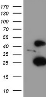 CENPH Antibody