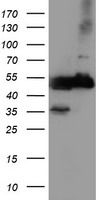 TUBAL3 Antibody