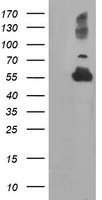 TUBAL3 Antibody