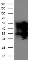 TAL1 Antibody
