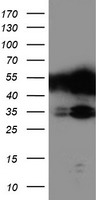 TAL1 Antibody