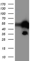 TAL1 Antibody