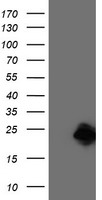 CENPH Antibody