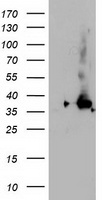 NUDT18 Antibody