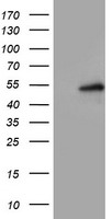 Lipoprotein lipase Antibody
