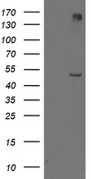 Lipoprotein lipase Antibody