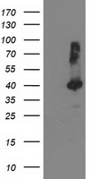 TBC1D21 Antibody