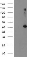 TBC1D21 Antibody