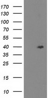 TBC1D21 Antibody