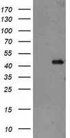 TBC1D21 Antibody
