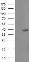 TBC1D21 Antibody