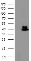 TBC1D21 Antibody