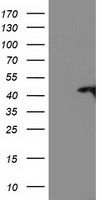 TBC1D21 Antibody