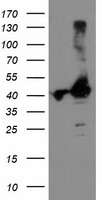 TBC1D21 Antibody