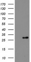 DTYMK Antibody