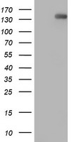 ERBB2 Antibody