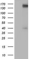 ERBB2 Antibody