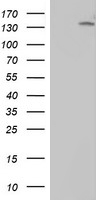 ERBB2 Antibody