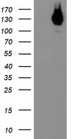 Her2 Antibody